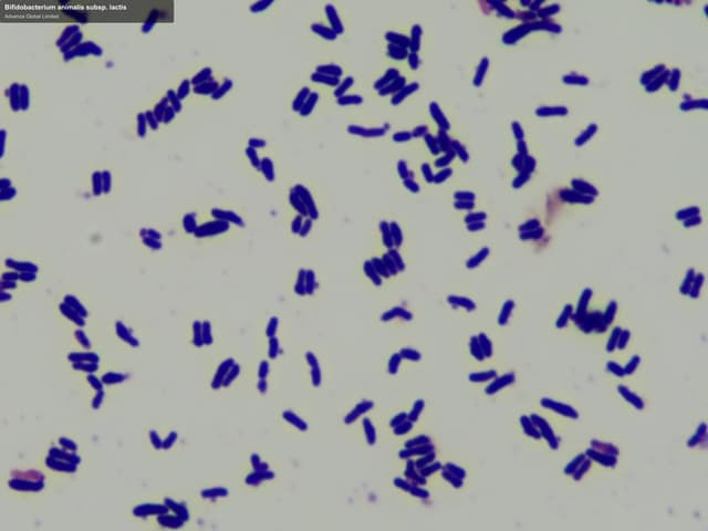Advenza Global Limited sell "Bifidobacterium animalis subsp. lactis"