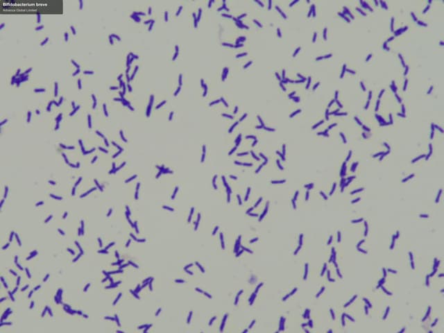 Advenza Global Limited sell "Bifidobacterium breve"