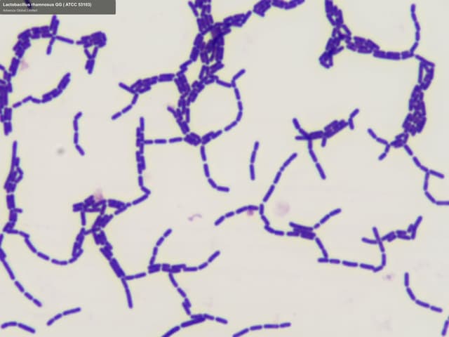 Advenza Global Limited sell "Lactobacillus rhamnosus GG ( ATCC 53103)"