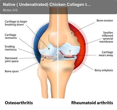 Biofac A/S sell "Native ( Undenatirated) Chicken Collagen type II"